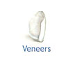 Veneers